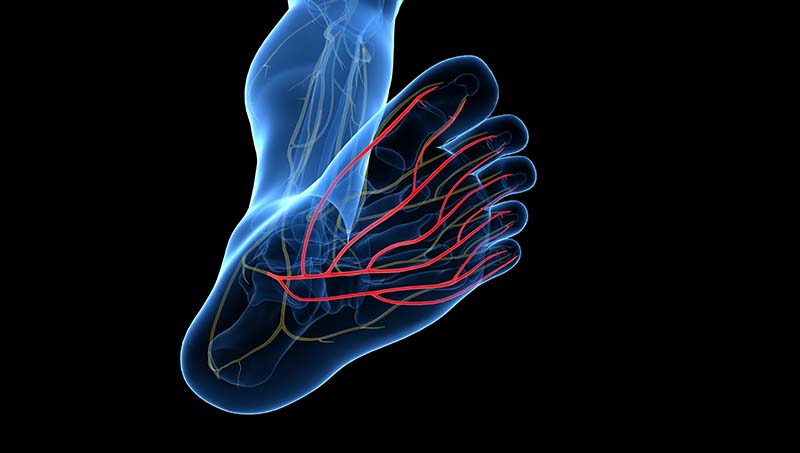 what-is-peripheral-neuropathy-san-jose-read-our-neuropathy-blog