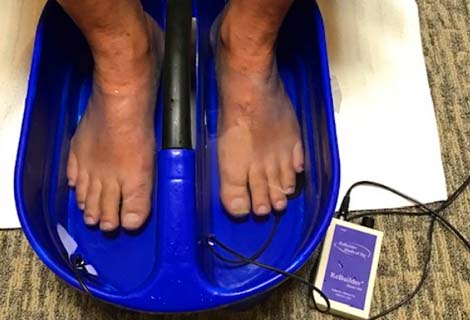 Electrical Stimulation Therapy for neuropathy relief